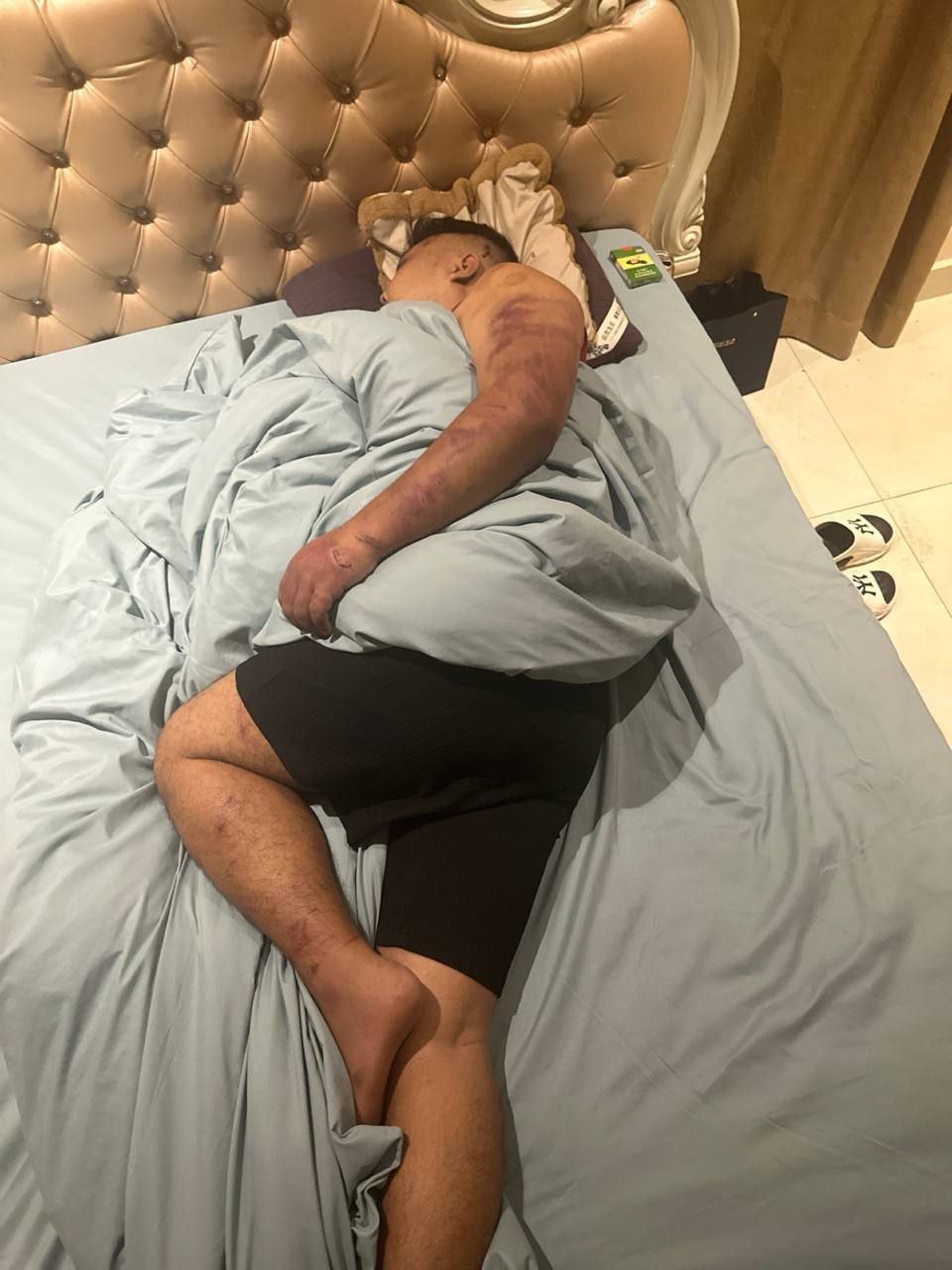 化名小马！周润发！盘口总监！因为公司欠他20多万U让我帮自导自演绑架！管公司要钱！期间只要公司的钱！跟我也协商好钱要回来会给我一部分！看公司不拿钱赎他！告诉我自己需要跑回去！这几天照片还有文字！真绑架他会这样吗！就是这样的状态吗